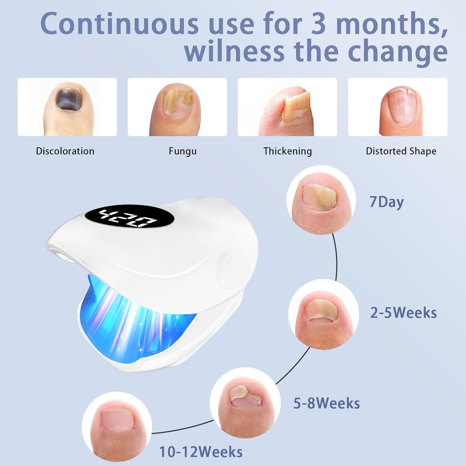Nail Fungus Laser Device 500NM - Galvanic Skin Sensor recension och pris